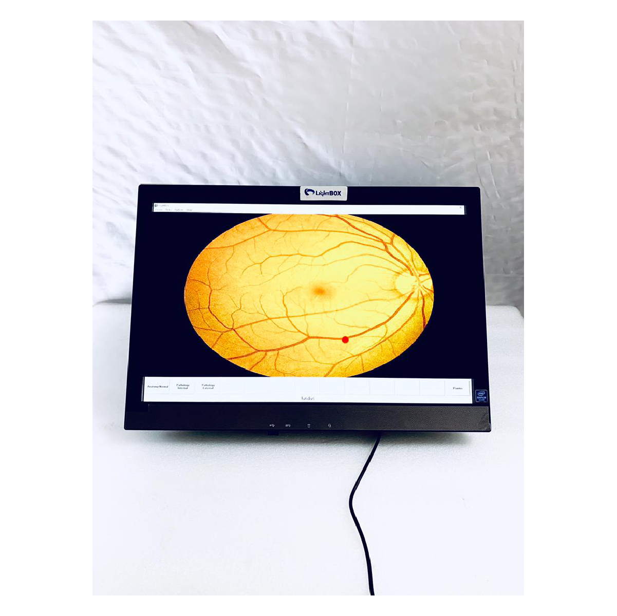 Automated Visual Acuity Chart | Lightbox ophthalmic equipment